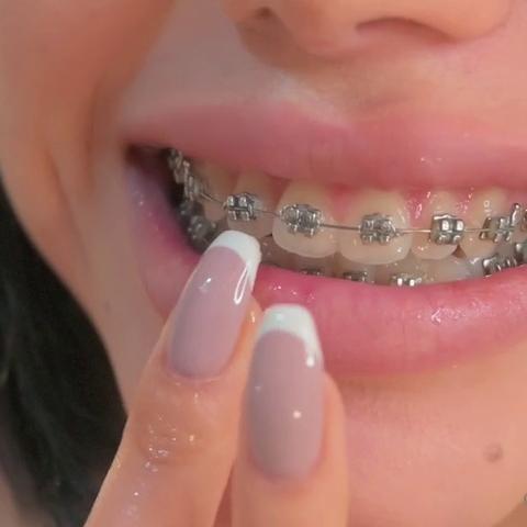 Ruth Lee Braces